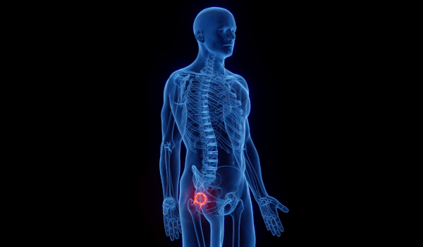 Robotic Hip Arthroplasty